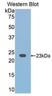 CD2 Antibody (aa23-203)