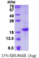 Human CD83 Protein (Recombinant His)
