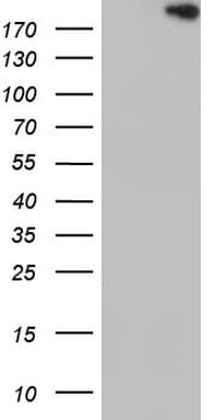 Monoclonal Mouse anti-Human TOP2A / Topoisomerase II Alpha Antibody (clone OTI10G10, aa1100-1531, WB)