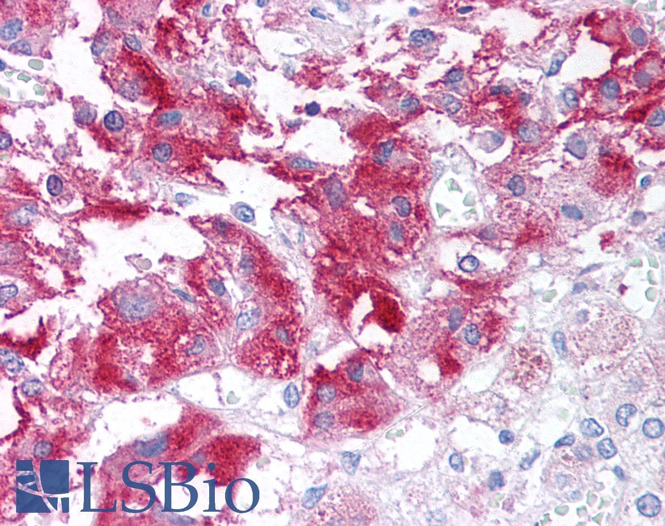 PathPlus™ USP20 / VDU2 Antibody (Internal)