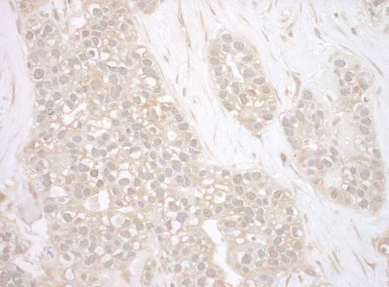 IHC-plus™ Polyclonal Rabbit anti-Human BAG3 / BAG-3 Antibody (aa300-350, IHC, WB)