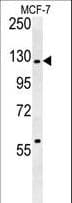 RABGAP1 Antibody (aa14-43)