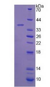 Human HSD17B12 Protein (Recombinant His)