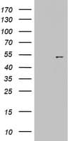 KRT20 / CK20 / Cytokeratin 20 Antibody (clone OTI5F1)