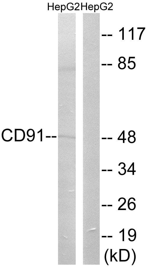 Polyclonal Rabbit anti-Human LRP1 / CD91 Antibody (p4520, WB)