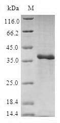 Human RS1 / Retinoschisin 1 Protein (Recombinant GST, N-terminus)
