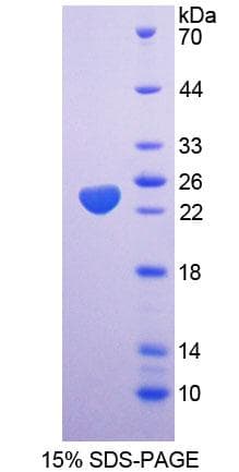 Rat SAT1 / SAT Protein (Recombinant His-T7)