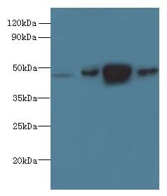 Polyclonal Rabbit anti-Human PRMT6 Antibody (IHC, WB)