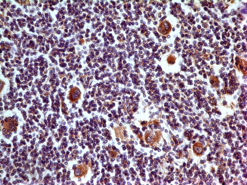 CD274 / B7-H1 / PD-L1 Antibody