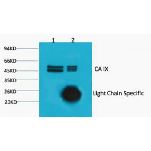 CA9 / Carbonic Anhydrase IX Antibody (clone 12F10)