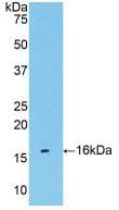 TMEM27 / Collectrin Antibody (aa17-137)