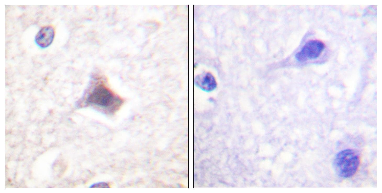 Polyclonal Rabbit anti-Human C/EBP Epsilon / CEBPE Antibody (p74, IHC, IF, WB)