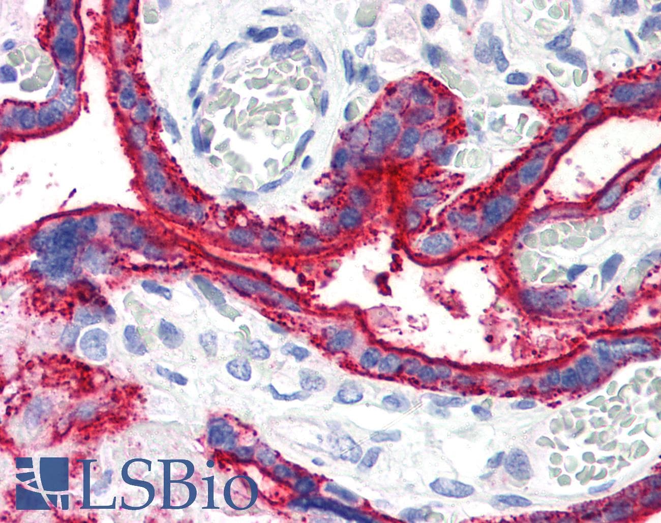 PathPlus™ Monoclonal Mouse anti-Human CD59 Antibody (clone MEM-43, IHC)