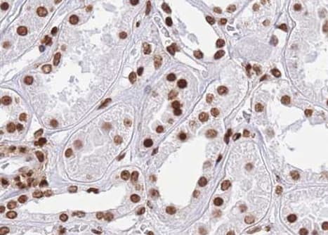 CTBP1 / CTBP Antibody (phospho-Ser422)