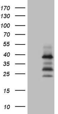 DJ858B16.2 / PISD Antibody (aa80-340, clone OTI5G2)