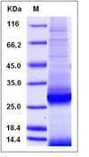Mouse APOA1 / Apolipoprotein A 1 (Recombinant His,C-terminus)