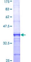 Human CD71 / Transferrin Receptor Protein (Recombinant GST, N-terminus)
