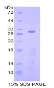 Human SELP / P-Selectin / CD62P Protein (Recombinant His-T7)