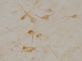 SLC5A7 / Choline Transporter Antibody (C-Terminus, clone 62-2E8)