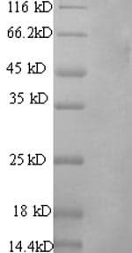 Rat PROS1 / Protein S (Recombinant 6His, N-terminus)