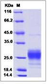 Mouse CCL2 / MCP1 Protein (Recombinant His,C-terminus)