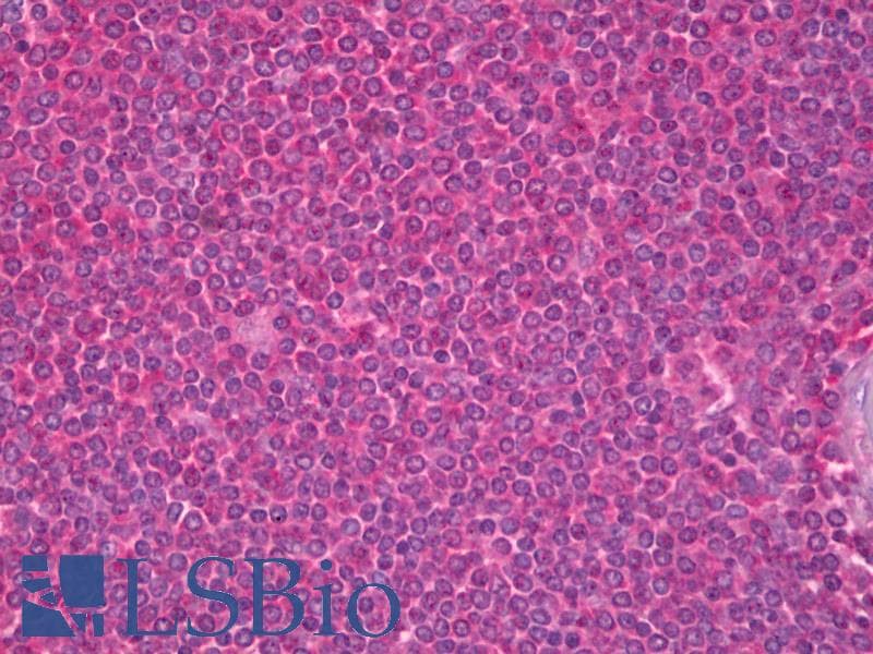 IHC-plus™ MAPK8 / JNK1 Antibody (clone 1E1)