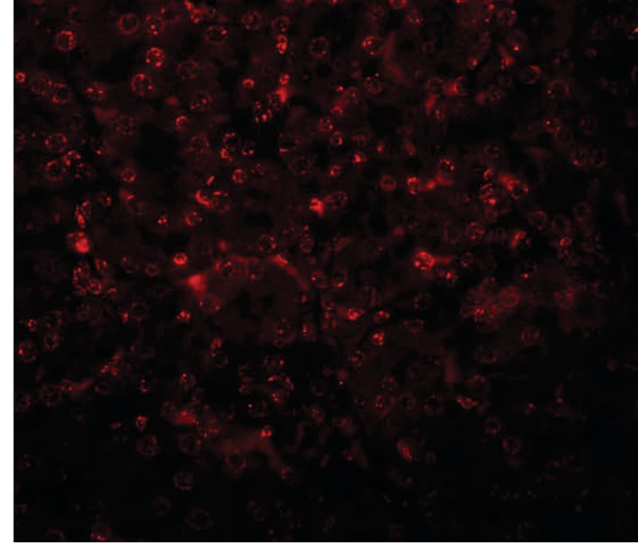 SLFN14 Antibody