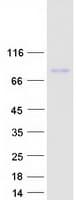Human ECM1 Protein (Recombinant Myc-DDK (Flag))