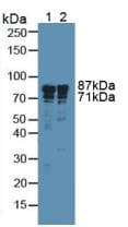 ITGB3 / Integrin Beta 3 / CD61 Antibody (aa135-377)