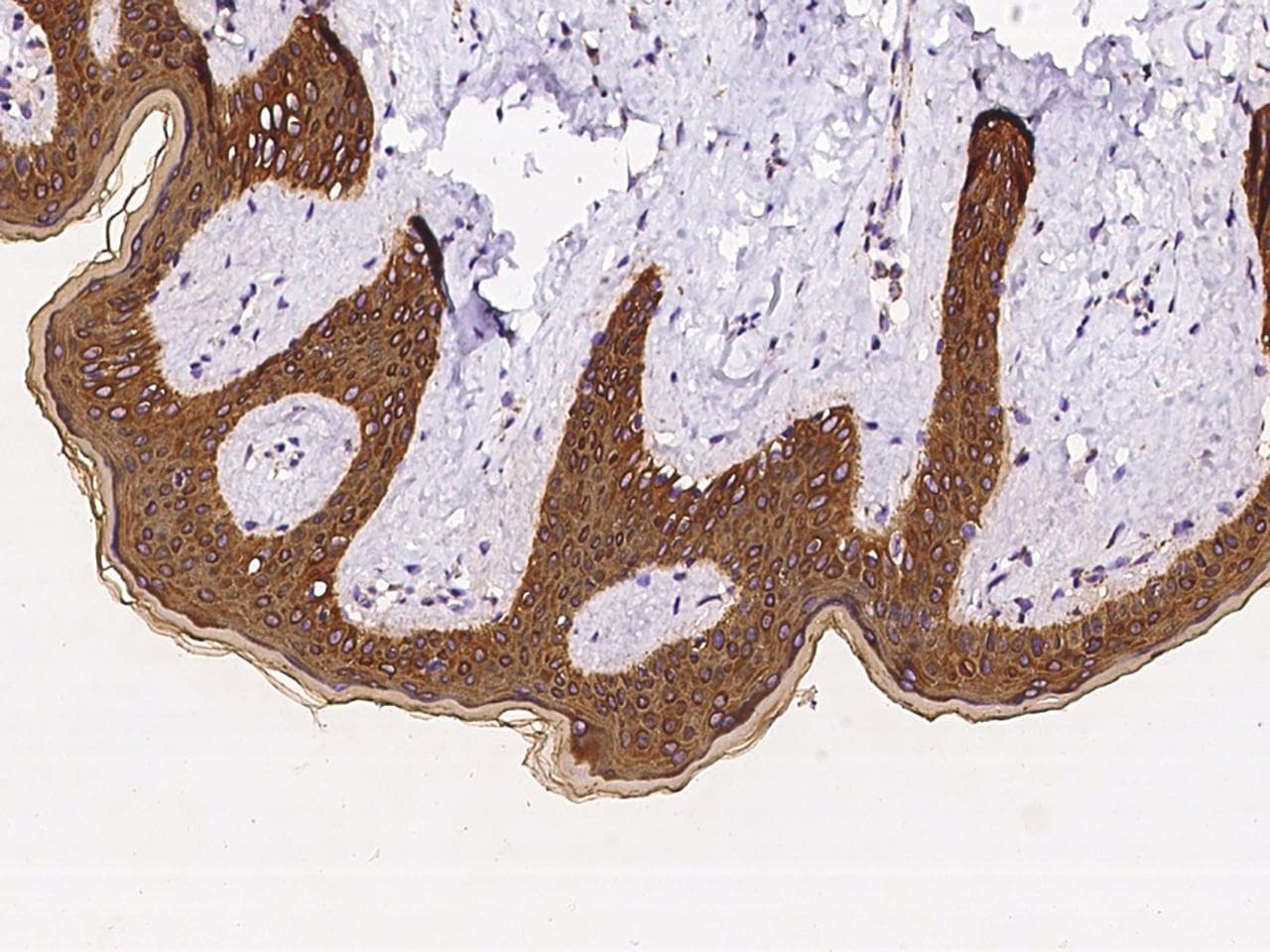 Polyclonal Rabbit anti-Human KRT79 / Keratin 79 Antibody (IHC)