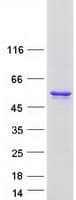 Human CYP26C1 Protein (Recombinant Myc-DDK (Flag))
