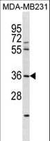 RNF217 / IBRDC1 Antibody (aa13-40)