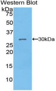 PDK1 Antibody (aa172-399, APC)