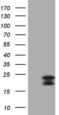 GLOD2 / MCEE Antibody (clone OTI6A1)