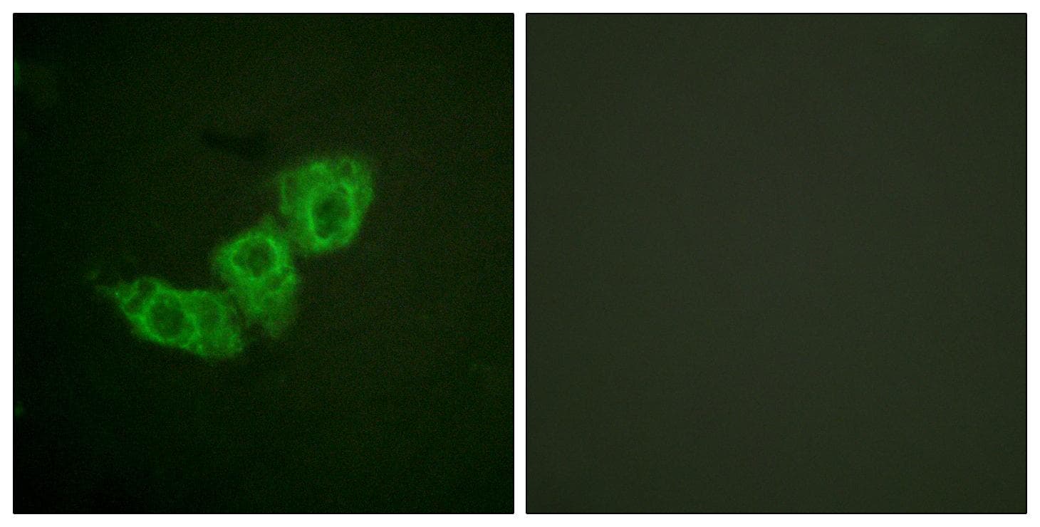 EGFR Antibody (phospho-Thr678)