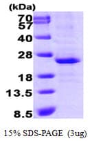 Human LIN28A / LIN28 Protein (Recombinant His)