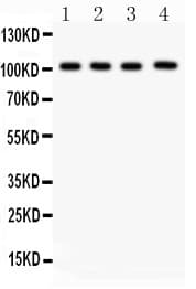 Polyclonal Rabbit anti-Human NRP1 / Neuropilin 1 Antibody (aa504-827, IHC, WB)