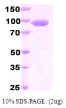 Human DPP4 / CD26 Protein (Recombinant His)