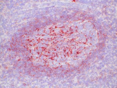 Monoclonal Mouse anti-Human Lambda Light Chain Antibody (clone lamba 1 - biotin, IHC)
