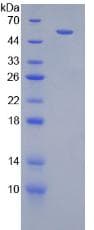 Mouse CD119 / IFNGR1 Protein (Recombinant GST)