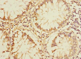 PLK3 Antibody
