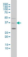 BMI1 / PCGF4 Antibody (clone 4E10-1C5)