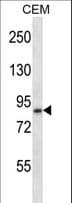 ADAM11 Antibody (aa200-228)
