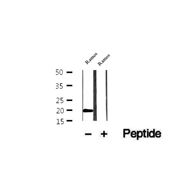 FAM96B Antibody