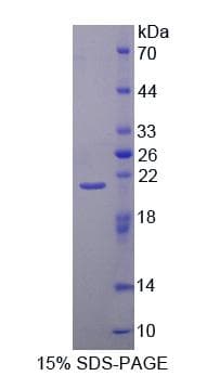 Human DNAJC4 Protein (Recombinant His-T7)