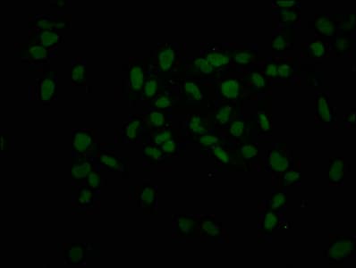 Polyclonal Rabbit anti-Human HIST1H3A Antibody (IHC, IF, WB)