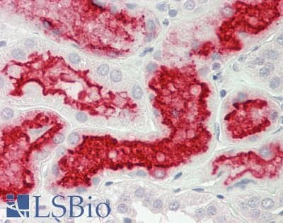 IHC-plus™ ACE2 / ACE-2 Antibody (aa18-237, clone 1G4)