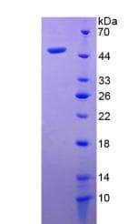 Mouse Adiponectin Protein (Recombinant His-GST)