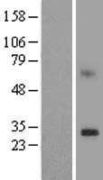 TMEM189 Protein (Over-Expression Lysate Myc-DDK (Flag))