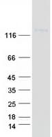 Human ITGA9 / Integrin Alpha 9 Protein (Recombinant Myc-DDK (Flag))